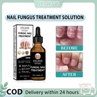 EELHOE Nail Repair Solution Onychomycosis Repair Solution Treatment of Onychomycosis Nail Thickening