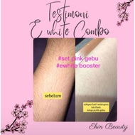 Ewhite Lotion Ekin Beauty