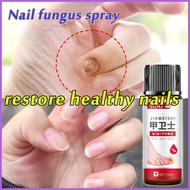 ✓ △ ◵ ️️Bonil Anti Fungal Solution 50ml Nail Repair Nail Fungal Treatment Anti-fungal Care Set Tool