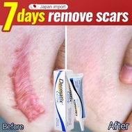 Scar Removal  Scar Gel Acne Scar Removal Old Scar Mosquito Bite Scar Cream Keloid