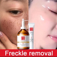 Krim jeragat Freckle cream Dark spot serum美白祛斑霜 Remove melanin whitening freckle cream