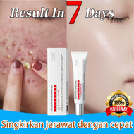【100% Original】Acne and acne scar medication acne scar removal acne ointment 15g most effective acne