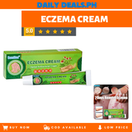 Eczema Treatment herbal antibacterial cream Safe and no side effects, effective in one day, psoriasi