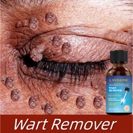 Ubat Kutil Muka Wart Remover Ubat Ketuat Leher Tahi Lalat Remover Ubat Ketuat Kelamin Skin Tag Remov