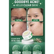 sevendayz 7dayz anti Acne pro,pimples cream,acne,
