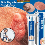 COD Warts remover original Mole remover Skin tag remover kasoy cream wart removal
