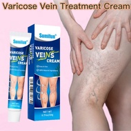 Varicose veins cream Hilangkan urat bengkak Varicose veins treatment baiki urat Spider Veins Treatme