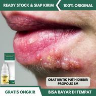 Obat Bintik Putih Di Bibir Obat Herpes Bibir Fordyce Spots / Bintik Putih di Bibir Bibir Pecah dan K