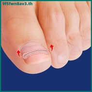 Professional Ingrown Toenail Corrector Treatment