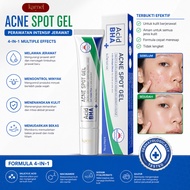 Korecetic Acne Spot Gel 15g Acne Spot Treatment Acne Spot Gel Acne Treatment Cream