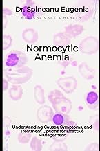 Normocytic Anemia: Understanding Causes, Symptoms, and Treatment Options for Effective Management