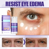 Eelhoe Eye Cream Moisturizing and Nourishing Eye Lift Firming Skin Fading Wrinkle Fishtail Pattern Dark Circles Massage Cream