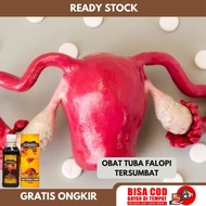 Obat Saluran Tuba Falopi Tersumbat - Obat Tuba Falopi Tersumbat -