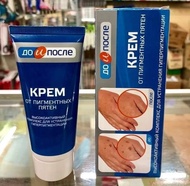 [HÀNG XÁCH TAY NGA] Kem Đồi Mồi Đốm Nâu Da Tay Kpem Hàng Nga (Russian mart Linh Sơn)