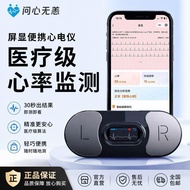 ECG Monitor Portable ECG Heart Monitor Heart Monitor Medical Early Fight Room Vibrating Heart Rate H