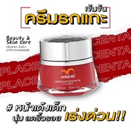 รีเบิร์ท ครีมรกแกะสูตรเข้มข้น REBIRTH ADVANCED PLACENTA CONCENTRATE (50ml)