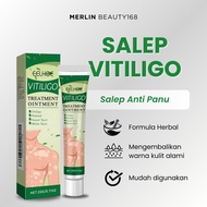 EELHOE Soralen Obat Vitiligo Treatment Ointment 20g White Spot Skin Repair Mycotic Leukoplakia Treat