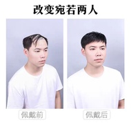 Kepala pria pengganti rambut nyata potongan pengganti rambut tak terlihat dahi botak kepala botak sa