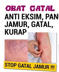 [TERMURAH]DERMIFAR CLOTRIMAZOLE SALEP Kulit Gatal Jamur ditubuh-Salep Ampuh Kulit Gatal,jamur,panu,k