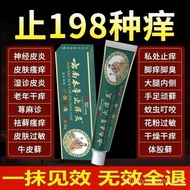 [Yunnan Anti-Itch Cream]Special Effect Itch Relief Fast Itch Relief Skin Itching External Use Dry It