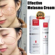 HIISEES Effective Melasma Cream 20g Freckles removal dark spots age spots whitening anti-wrinkle brightening skin