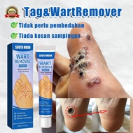 Ubat ketuat skin tag remover mole remover wart removal ketuat remover ubat ketuat paling berkesan