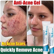 ACNE TREATMENT CREAM ANTI-BACTERIAL Acne removal cream anti-inflammatory acne cream acne TREATMENT a