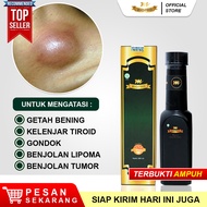 Obat Kelenjar Paling Ampuh Kelenjar Getah Bening Kelenjar Tiroid Di Leher Kelenjar Atau Benjolan Kel