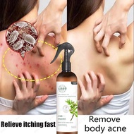 300ml Dust Mite Spray Dust Mite Remove Spray Non-toxic Natural Removal Acarid Spray Remove Bed Bug S