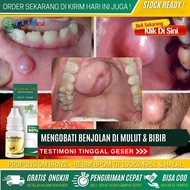 Obat Sakit Gigi Karena Abses Abses Gusi Pada Anak Obat Antibiotik Untuk Abses Gigi Abses Gusi Obat U