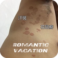 are white There some on body, brown patches under the armpits, tinea versicolor, fungal infection, c