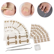 [szxmkj2lp] Ingrown Toenail Correction Kit Portable Ingrown Toenail Correction Patch