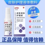 Yaguoning Skin Care Improves Dermatitis Eczema Sensitive Skin Causes Dryness Dedandruff Red Spots It