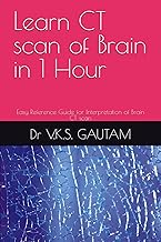 Learn CT scan of Brain in 1 Hour: Easy Reference Guide for Interpretation of Brain CT scan