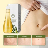 Stretch Mark Prevention Oil Marks Defense Olive Oil Pure Nourishing Pregnancy Stretch Mark Oil For P