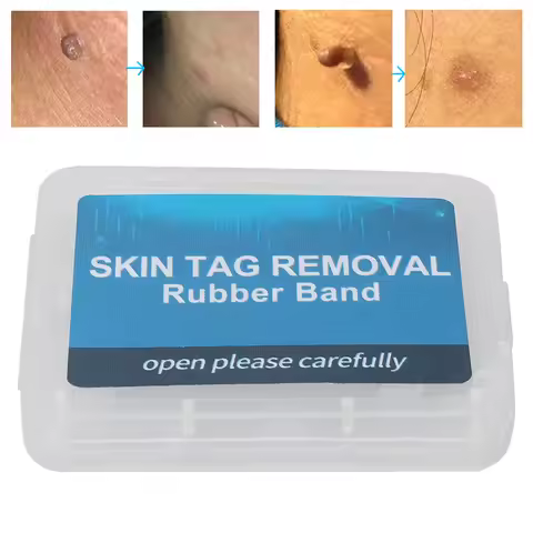 30Pcs Painless Skin Tag Removal Kit Mole Wart Remover Micro Skin Tag Treatment Removal Meat Nevus Co