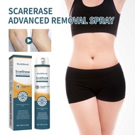 West&Month Scar Gel Acne Scars Treatment Scar Removal Cream Acne Scar Remover 20g Imports