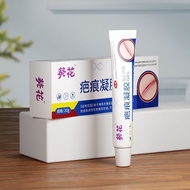 Medical Grade Children Can Use Post-operative Scars Burn Burn Scalds Increased Burn Sunflower Scars 