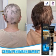 Serum penumbuh rambut Obat penumbuh rambut Penumbuh rambut botak Hair