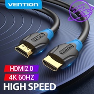 Vention HDMI Cable 4K HD TV Cable High Speed HDMI 2.0 Male to Male Cable 3D Effect Laptop Computer Connect to TV LCD Projector Monitor host Set top box Switch HDMI to HDMI Cable Laptop to TV 1M 1.5M 2M 3M 5M 8M 10M 12M 15M