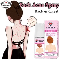 Tokyo Back Acne Spray Body Acne Treatment (Back&Chest) 60ml Remove Acne Marks, Acne, Pimple, Scar An