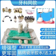 Self-Adhesive Porcelain Braces Steel Braces Braces Braces Dental Braces Dental Sticky Corolla Bondin