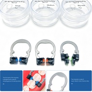 R5 Durable NITI Matrix Bands Ring Garrison Style Matrix Clamp Clip Sectional Contoured Matrices