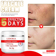 melasma and pekas remover cream original jekina melasma remover dark spot remover for face pekas cre