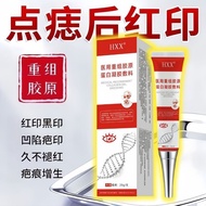 After Dotting Moles Red Marks Dent Scar Marks Biological Medical Reorganization Collagen Gel Dressin