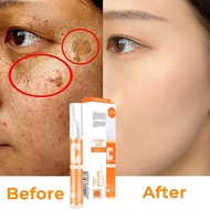 Krim jeragat lulus kkm Vc Fade Melanin Pen Whitening Freckle Blemish Spots Removal Cream Whitening E