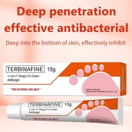 Terbinafine Antifungal Cream 15g Deep Penetration Relieve Athletes Foot Itching