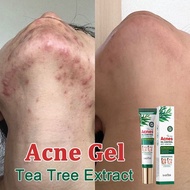 Acne cream Acne gel Face Cream ubat jerawat Krim Jerawat Muka Punggung pimple parut jerawat Penjagaa