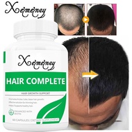 Hair Loss Vitamin Supplement - Promotes Rapid Hair Growth - DHT Blocker Capsules