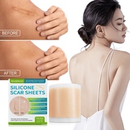scar tape keloid scar remover scar patch silicone scar sheet for Acne plaster